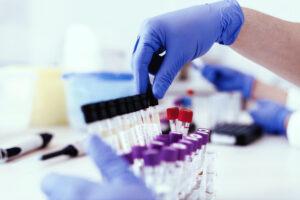 Scientist Extracting a Rack Tube With Urine Samples.
