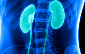 CKD